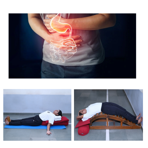 Digestive Disorder Therapy